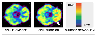 влияние мобильного телефона на мозг человека