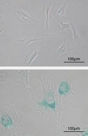 Picture showing cell senescence