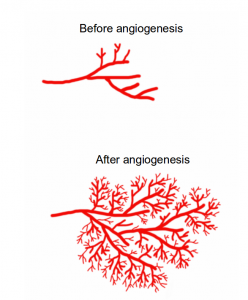 Graphic showing pre and post angiogenesis