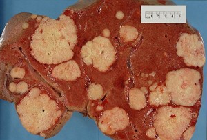 Cross section of human liver