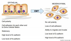 Graphic showing epithelial to mesenchymal transition