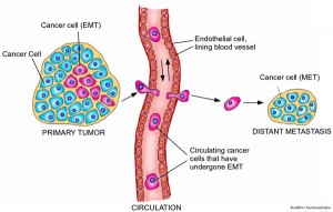 Graphic showing EMT and metastasis