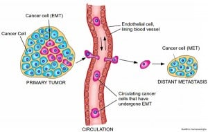 Graphic showing EMT and metastasis